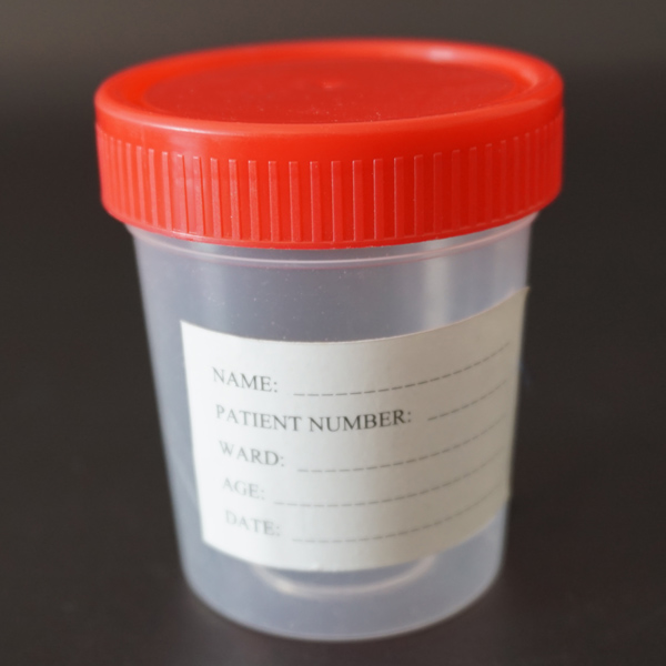 100ml URINE CONTAINE